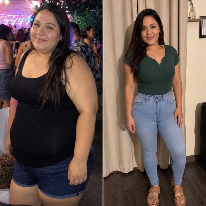Nova Health and Wellness patient before and after