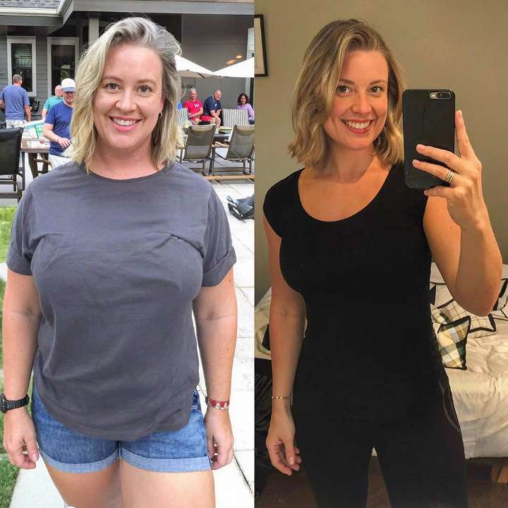 Nova Health and Wellness patient before and after